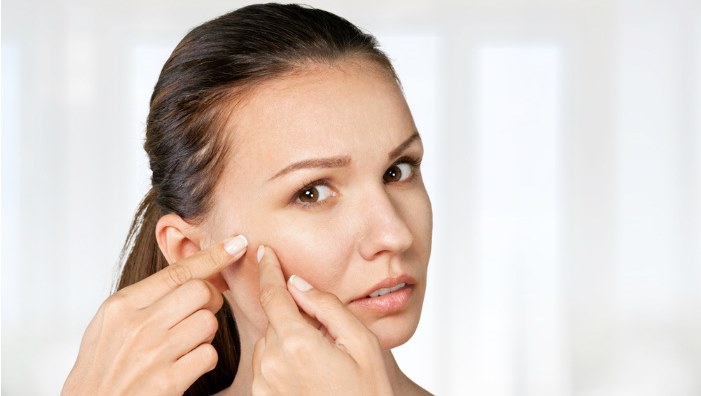 Best Home Remedies To Treat Acne
