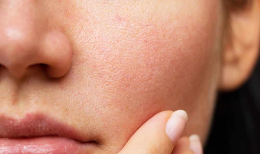 IGNORE Everything You Ever Heard About Pores – This Is How You’ll Make Them Smaller