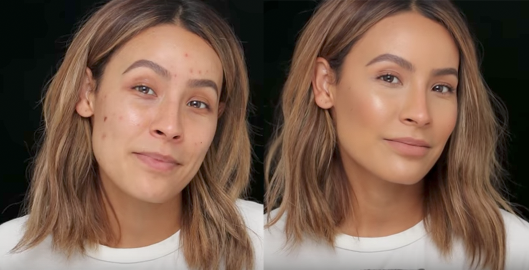 These Are the Only Hacks You Need to Make Broken-Out Skin Look Airbrushed