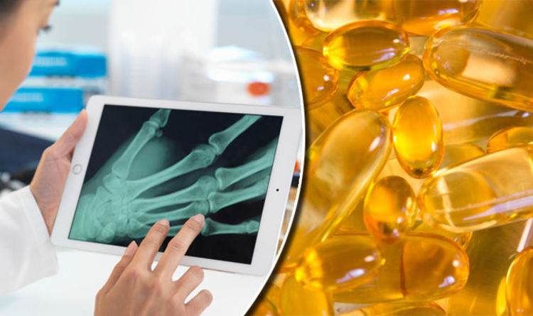 Best supplements for arthritis: These FOUR could be a natural CURE for painful symptoms