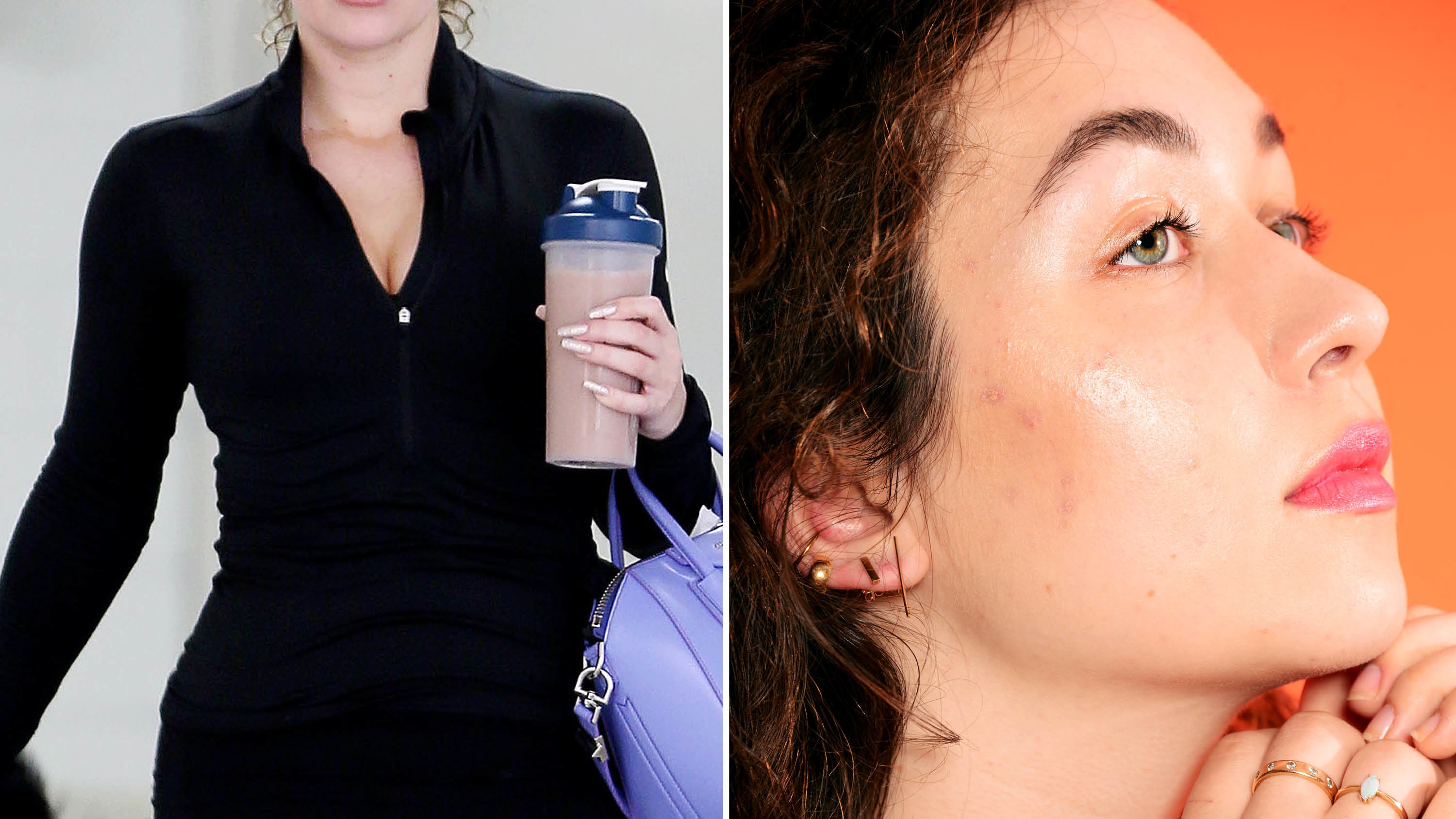 Does Whey Protein Cause Acne? The Correlation Between Breakouts and Protein Shakes